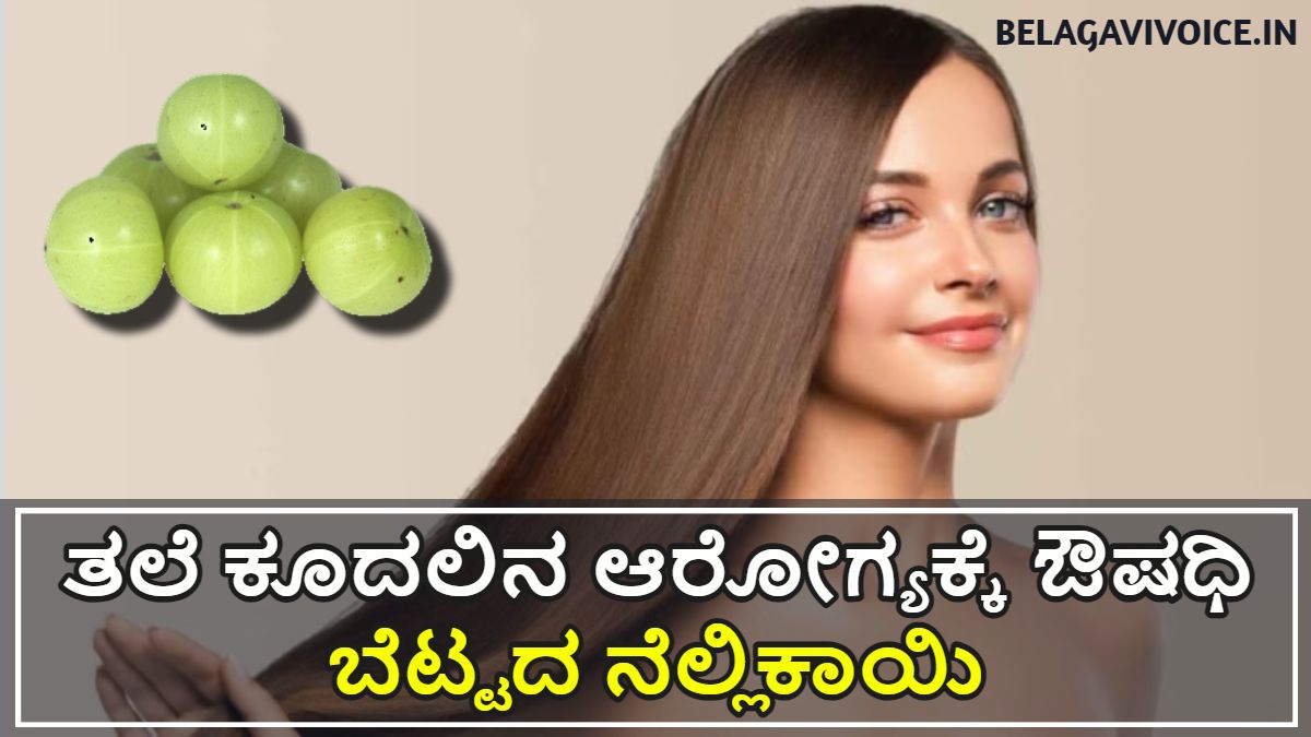 ತಲೆ ಕೂದಲಿನ ಆರೋಗ್ಯಕ್ಕೆ ಇಲ್ಲಿದೆ ಉತ್ತಮವಾದ ಔಷಧಿ.! ಇಲ್ಲಿದೆ ಮಾಹಿತಿ